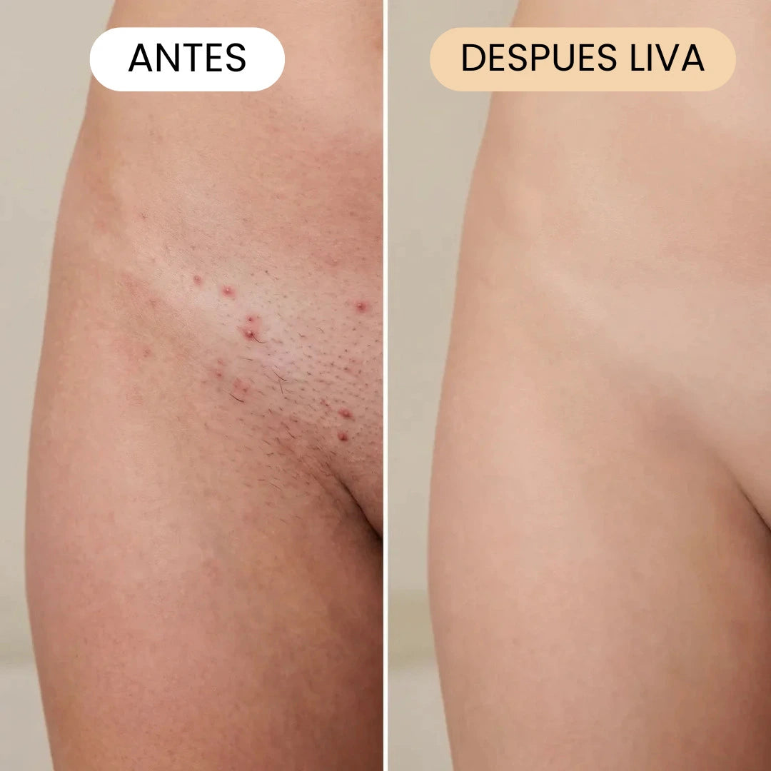 Solución suave para todas las zonas sensibles en 30 segundos