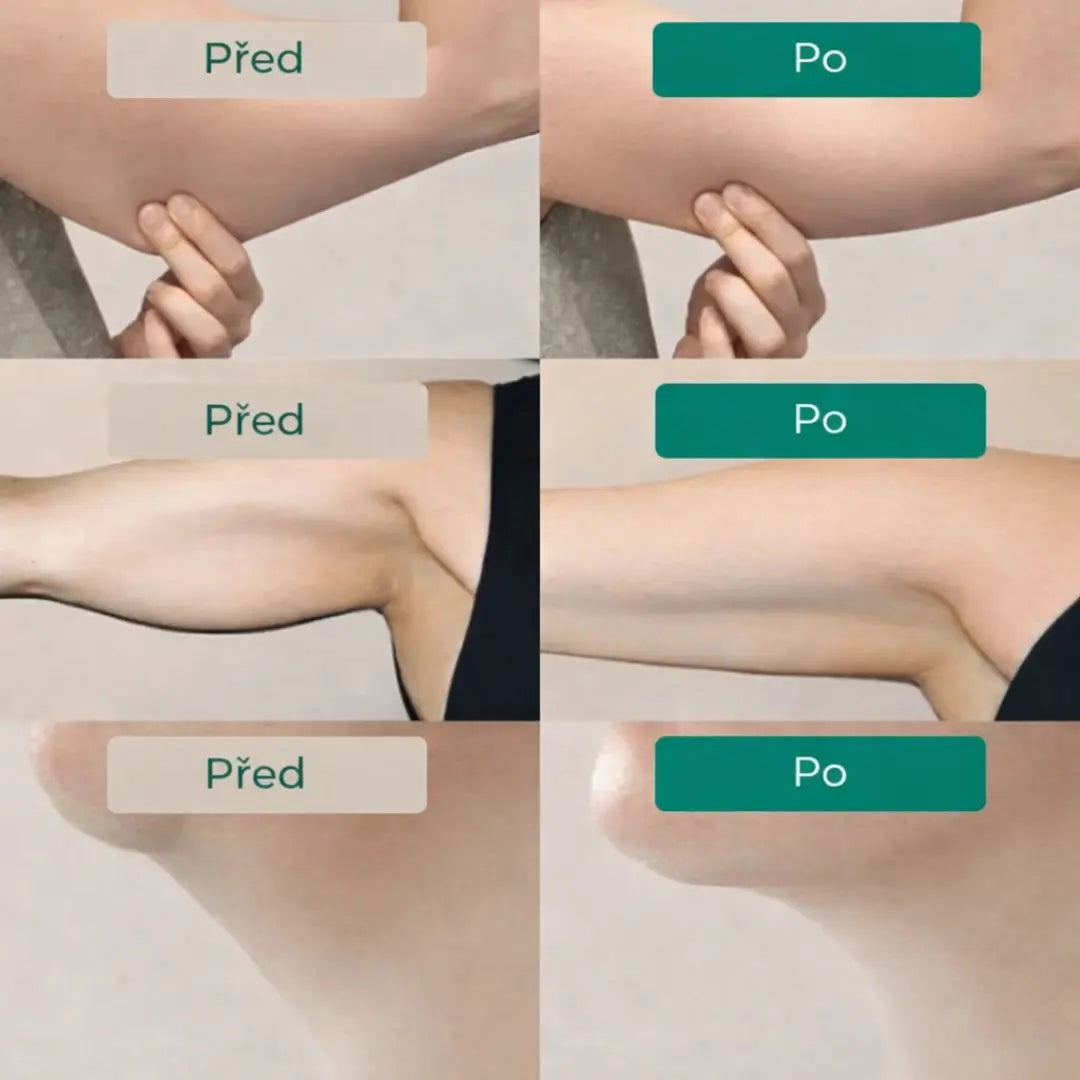 Tekutá lymfatická drenáž – štíhlejší obličej, lehké nohy, ploché břicho