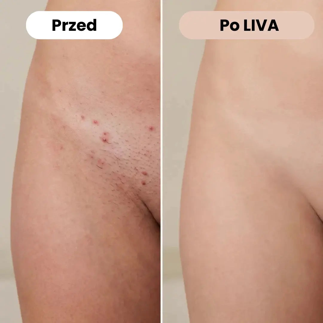 Delikatne rozwiązanie dla wszystkich stref wrażliwych w 30 sekund