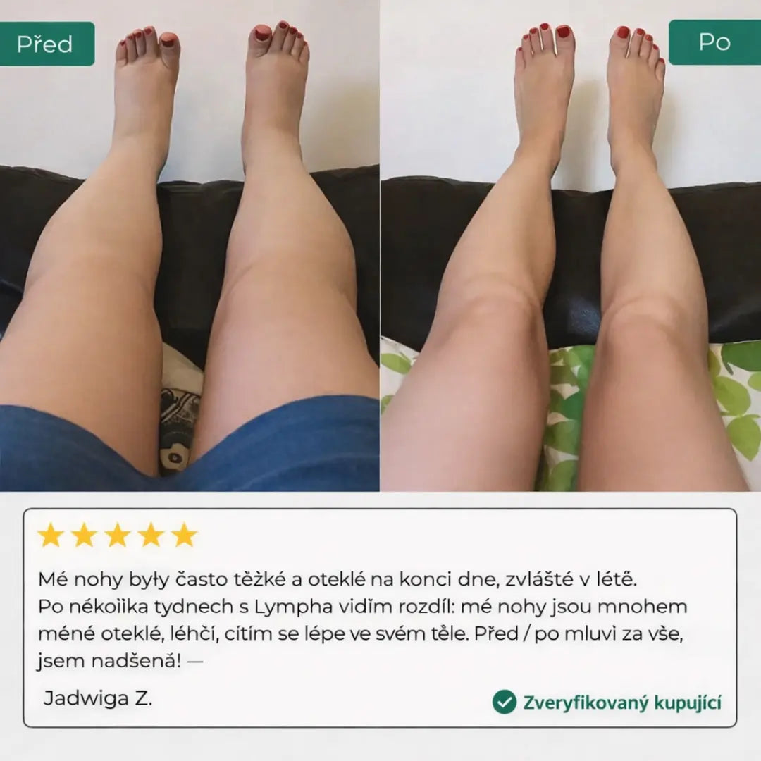 Tekutá lymfatická drenáž – štíhlejší obličej, lehké nohy, ploché břicho